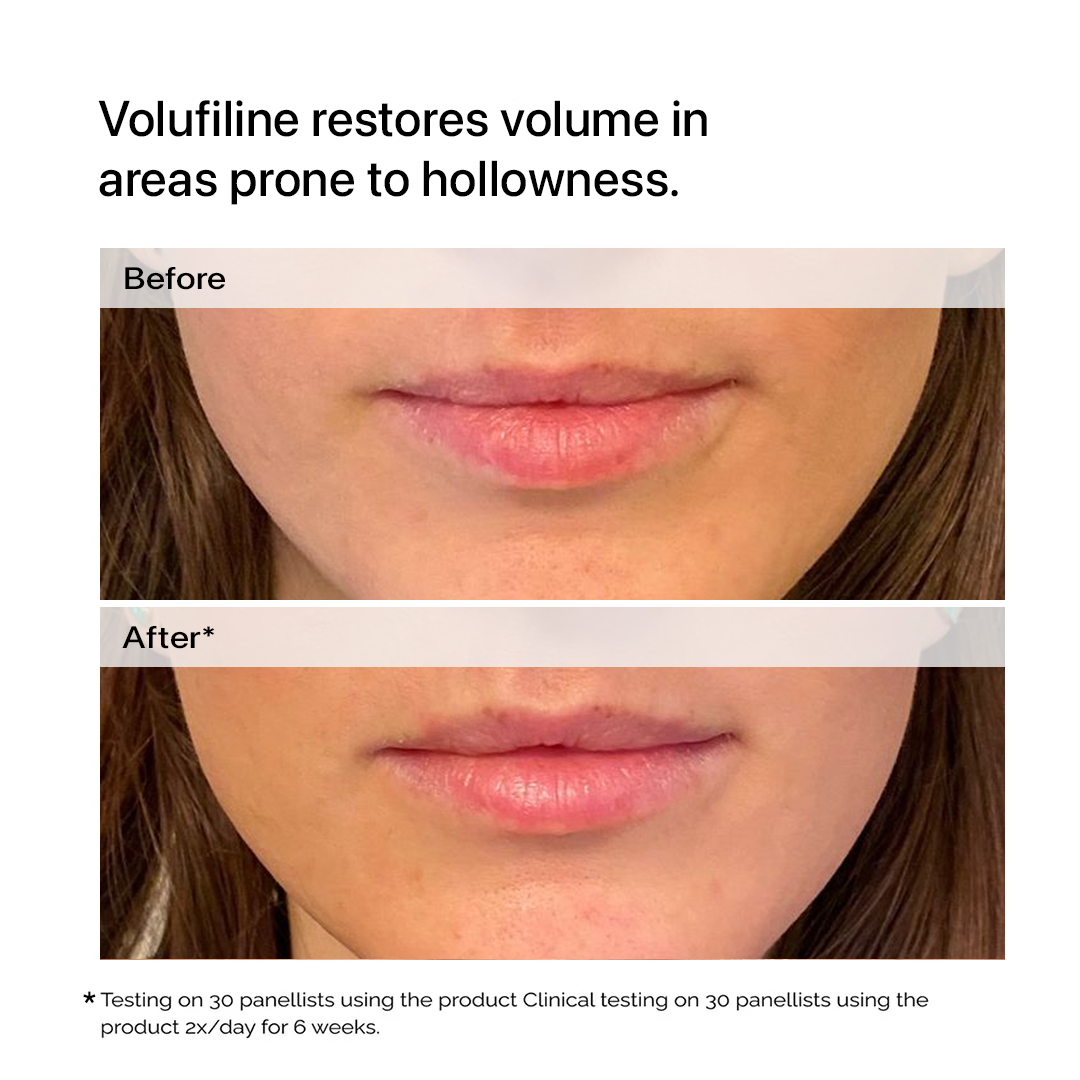 Volufiline Collagen Serum